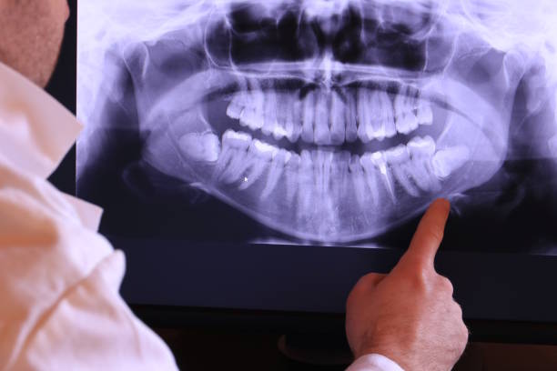 Best Broken or Cracked Tooth Emergency Dentist in Arnold, MD